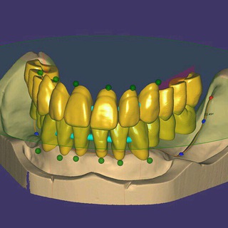 مكتبات اسنان للاكسوكاد exocad